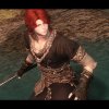 Thumbnail of related posts 102